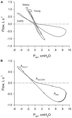 Plethysmographic Loops: A Window on the Lung Pathophysiology of COPD Patients